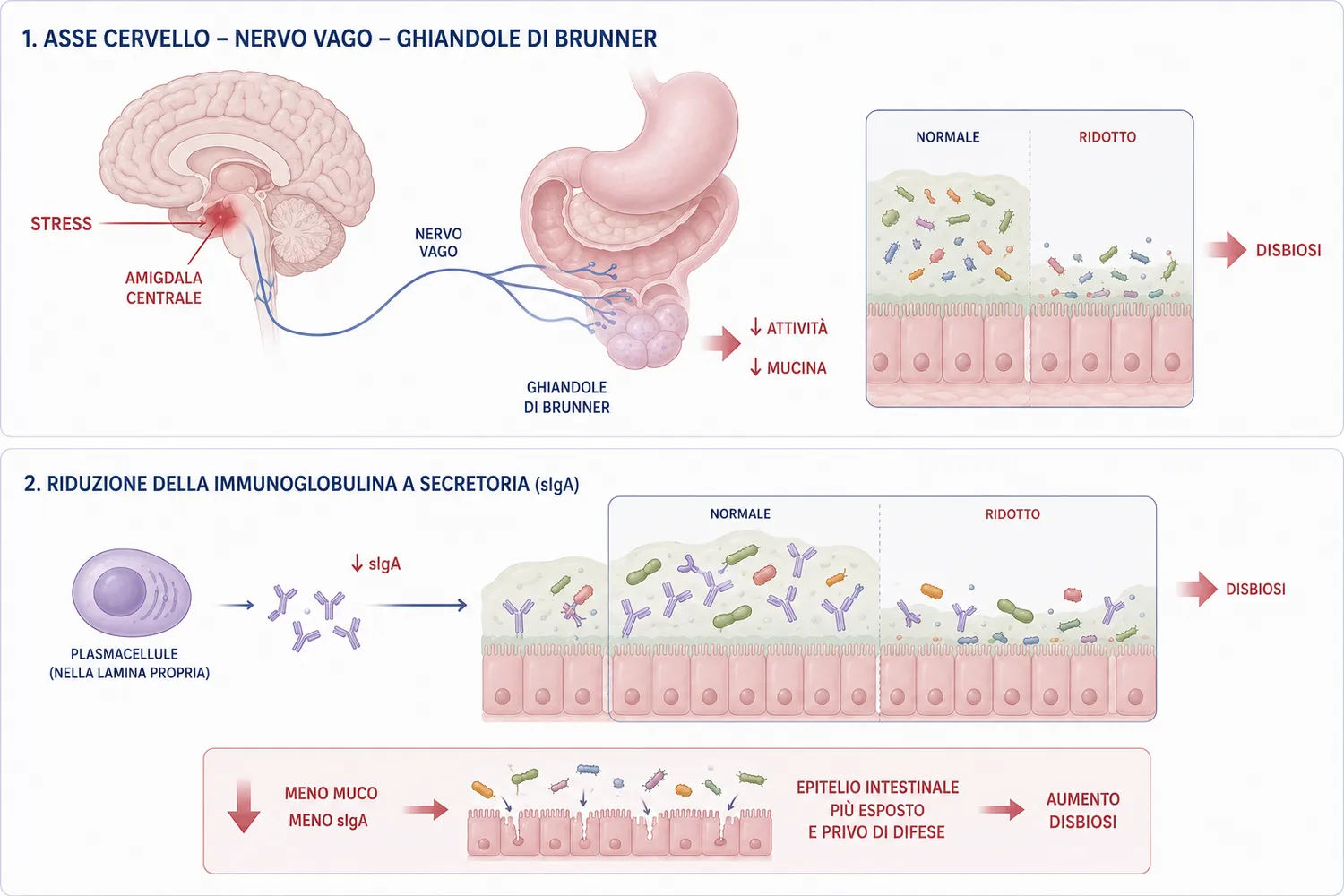 Il circuito amigdala–nervo vago–ghiandole di Brunner e la riduzione delle sIgA che portano alla disbiosi