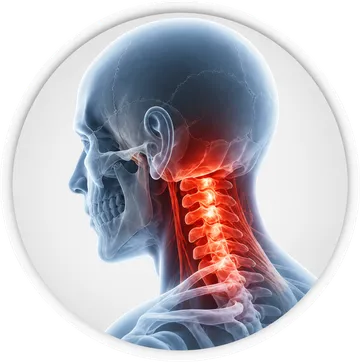 Collo e vertebre cervicali accesi di dolore: cefalea cervicogenica