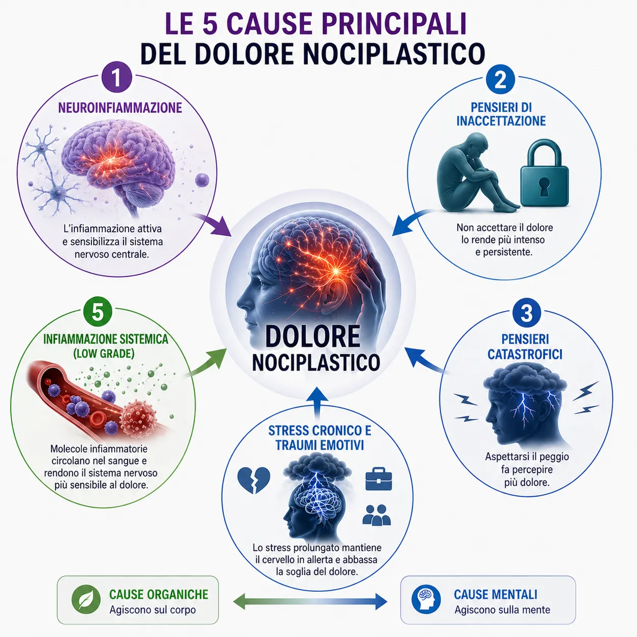 Le cinque cause principali del dolore nociplastico disposte attorno al cervello