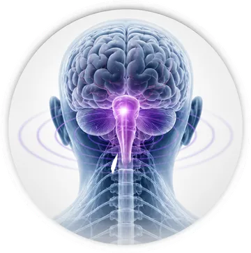 Tronco encefalico acceso: emicrania con aura del tronco encefalico